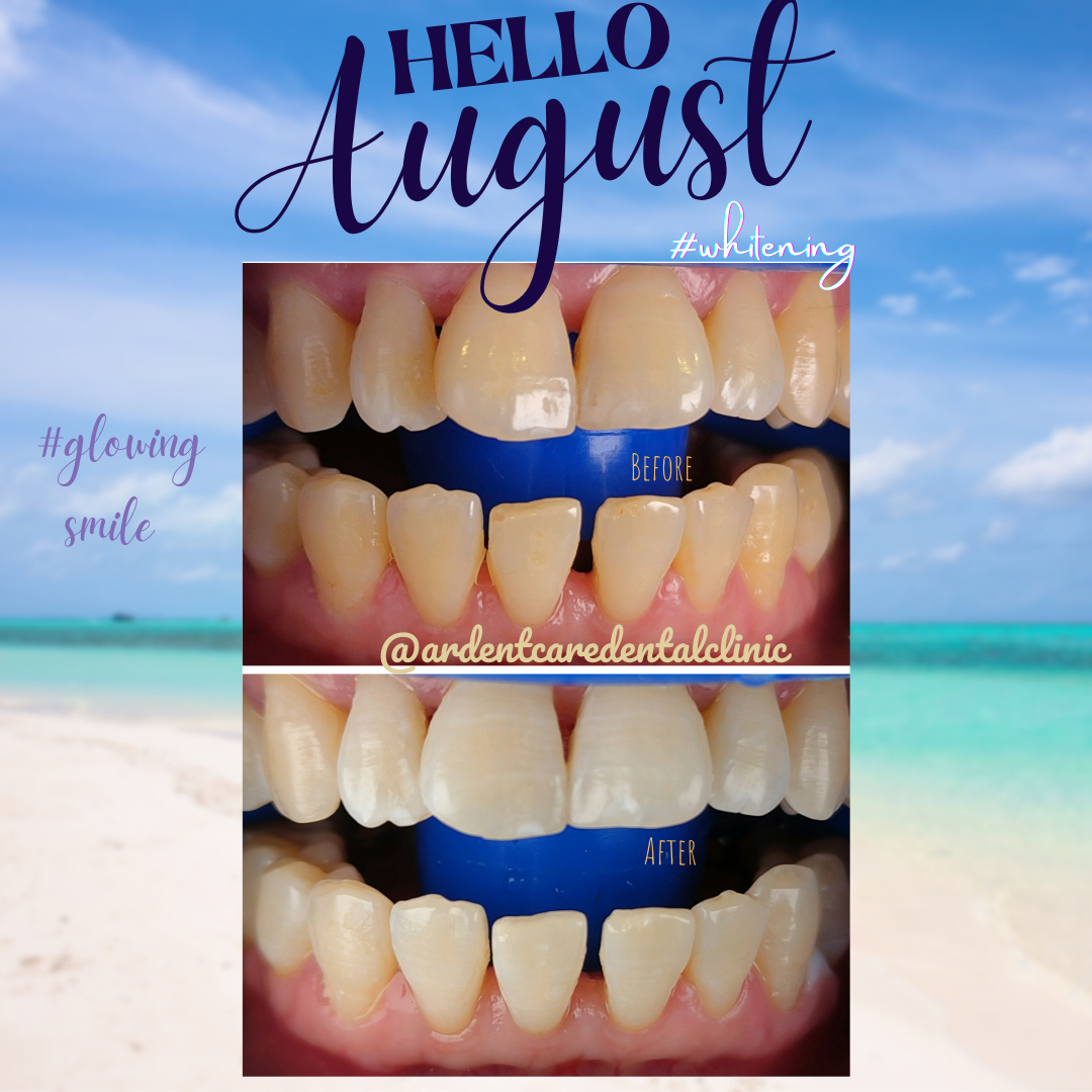 Ardent Care Dental Clinic - Braces & Implant — photo 2
