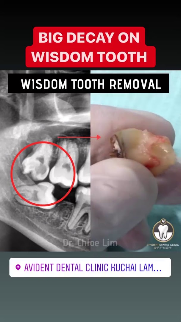 AVIDENT DENTAL CLINIC KUCHAI LAMA KL 爱艺牙科诊所 — photo 4