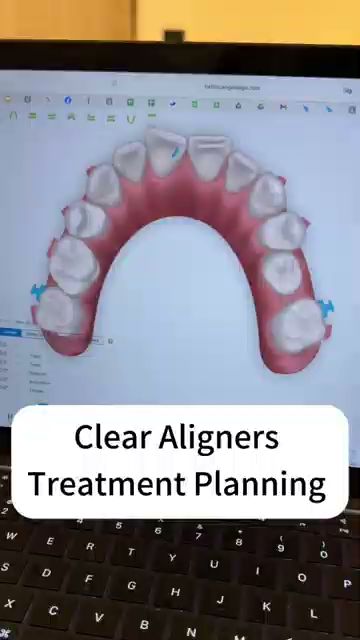 BIG Dental Setiawalk Puchong 牙科诊所｜Whitening, Braces, Veneers, Kid-Friendly Dental Clinic — dental clinic in Malaysia