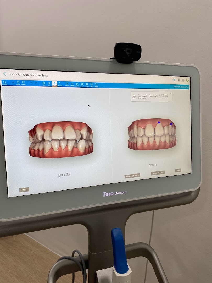 D DENTIST DENTAL CLINIC (INVISALIGN PLATINUM ELITE PROVIDER, IMPLANT CENTRE & KIDS FRIENDLY) — photo 2