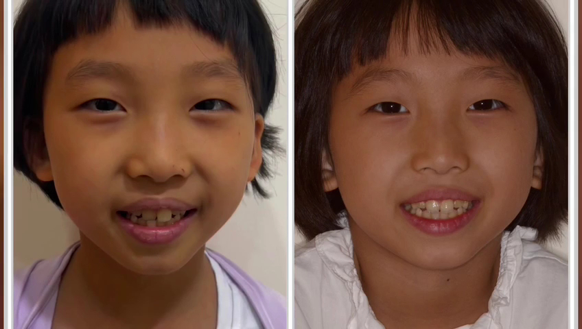 Dazzling Smiles Dental Clinic|Kuchai Lama|微笑牙科诊所|Platinum Invisalign Provider| Braces|Dental ImplantsIDental Esthetic|Veneers — photo 2
