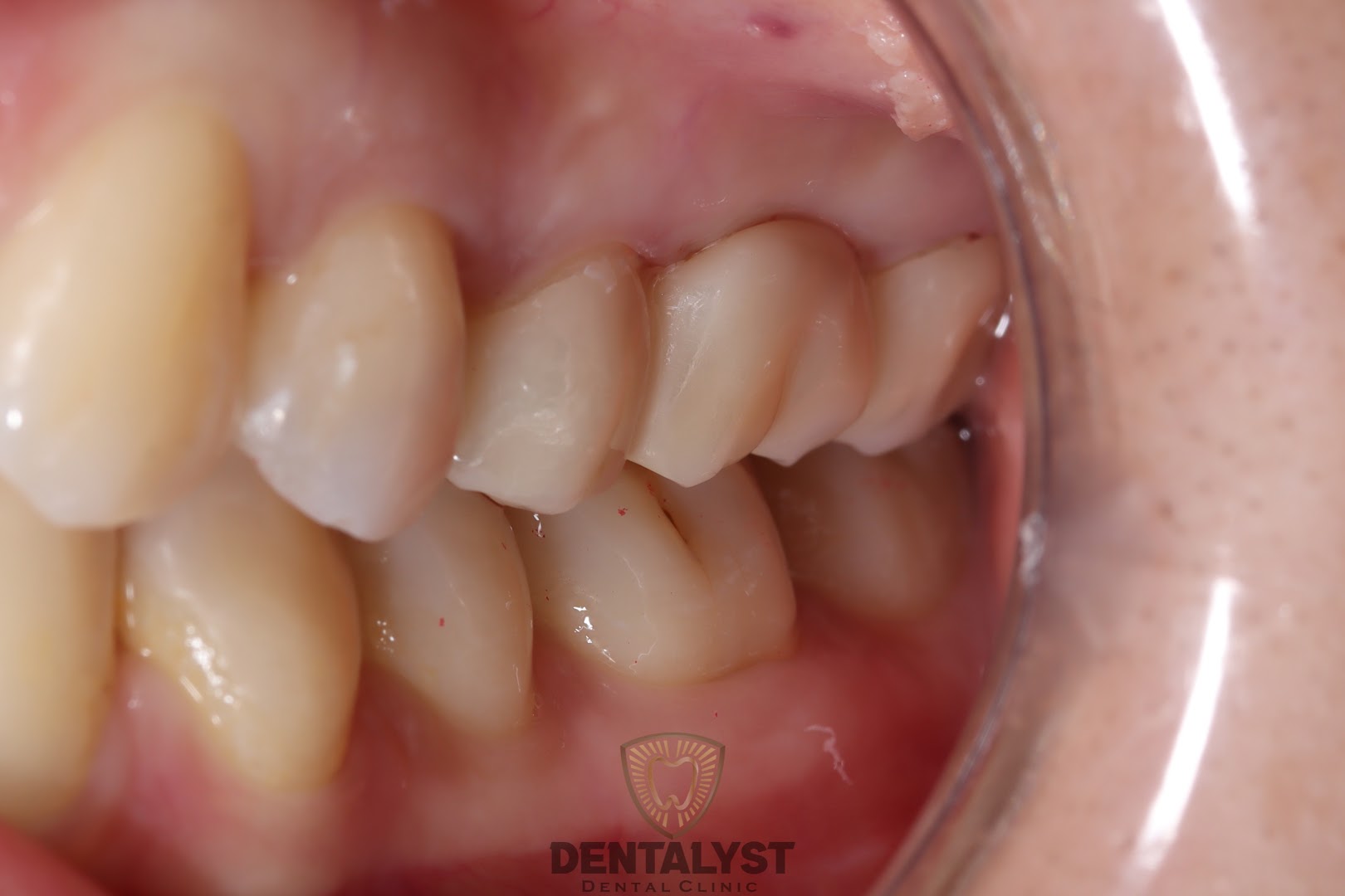 Dentalyst Bandar Botanik(Not Government Clinic) — photo 3