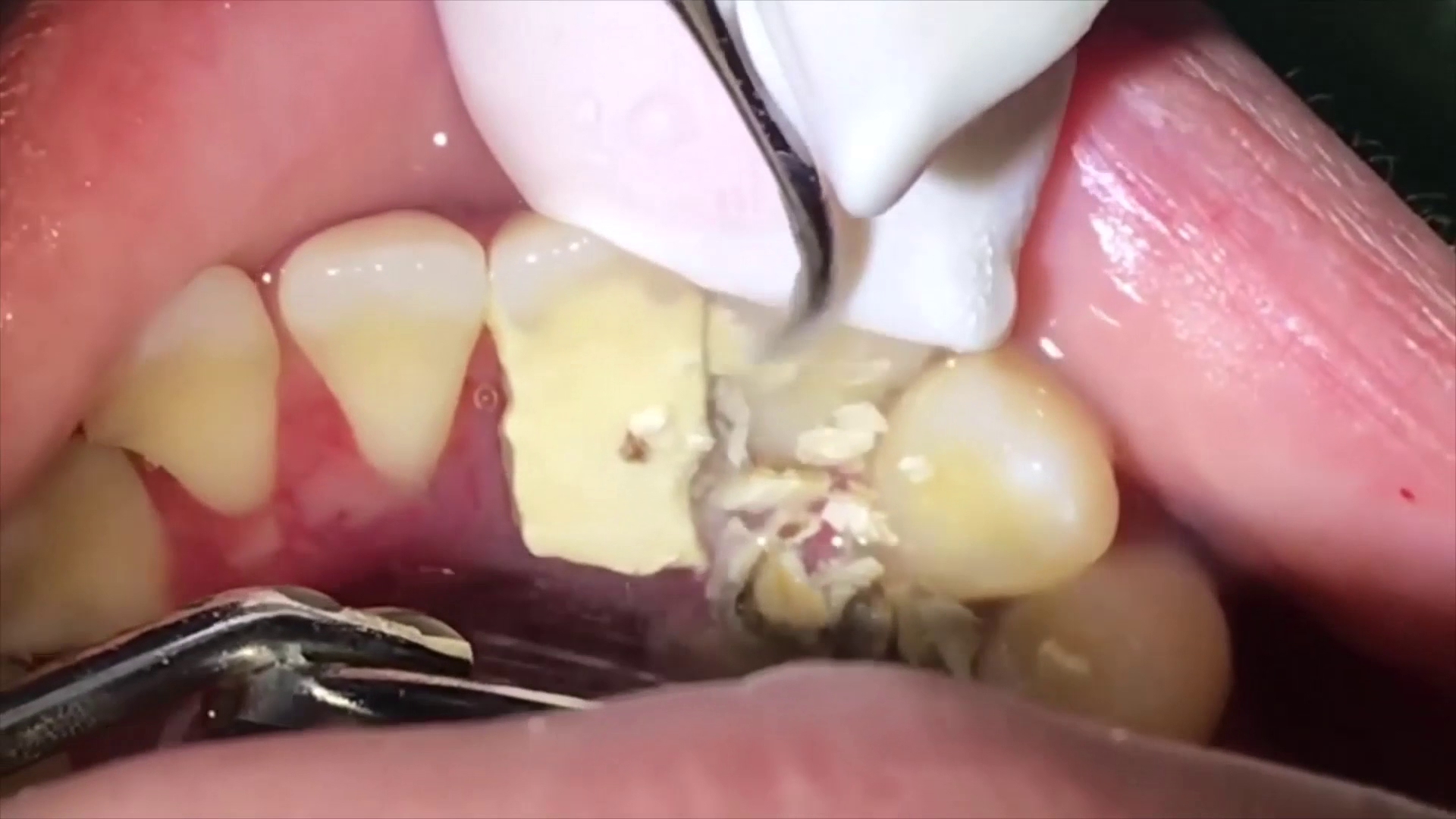 Gentle Dental Surgery | Klinik Pergigian Gentle — photo 2