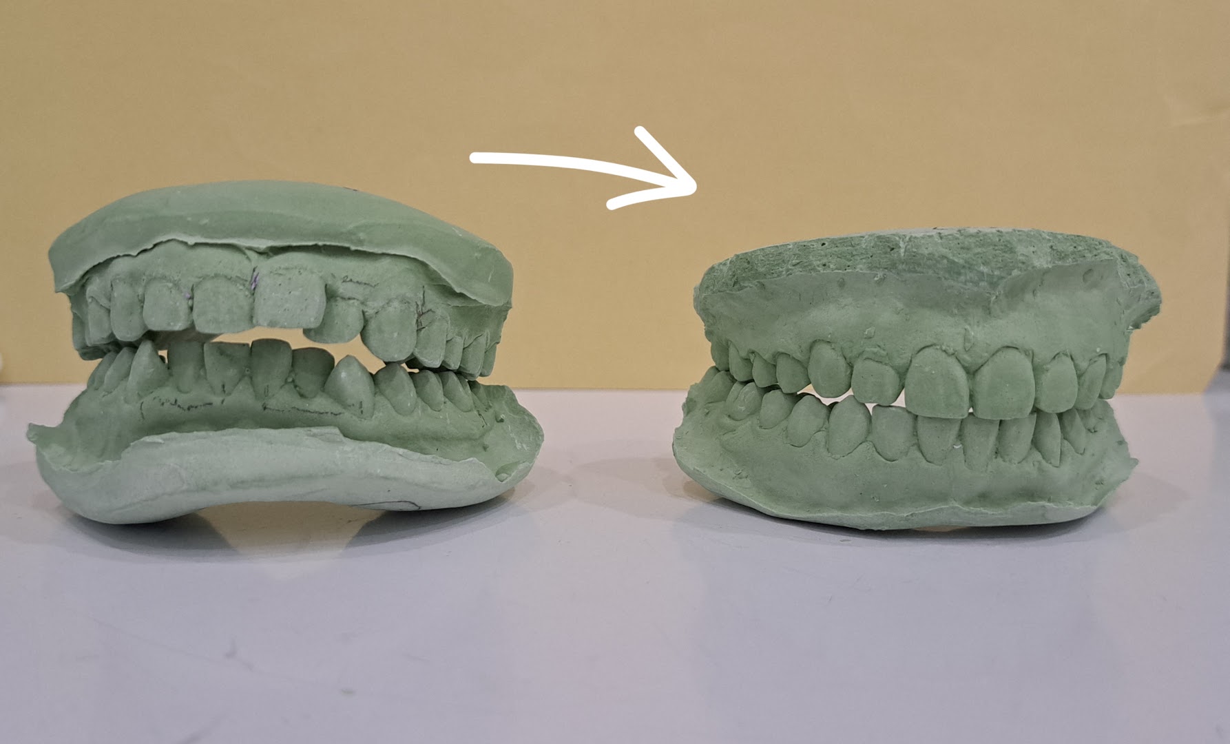 happy teeth dental surgery — dental clinic in Malaysia