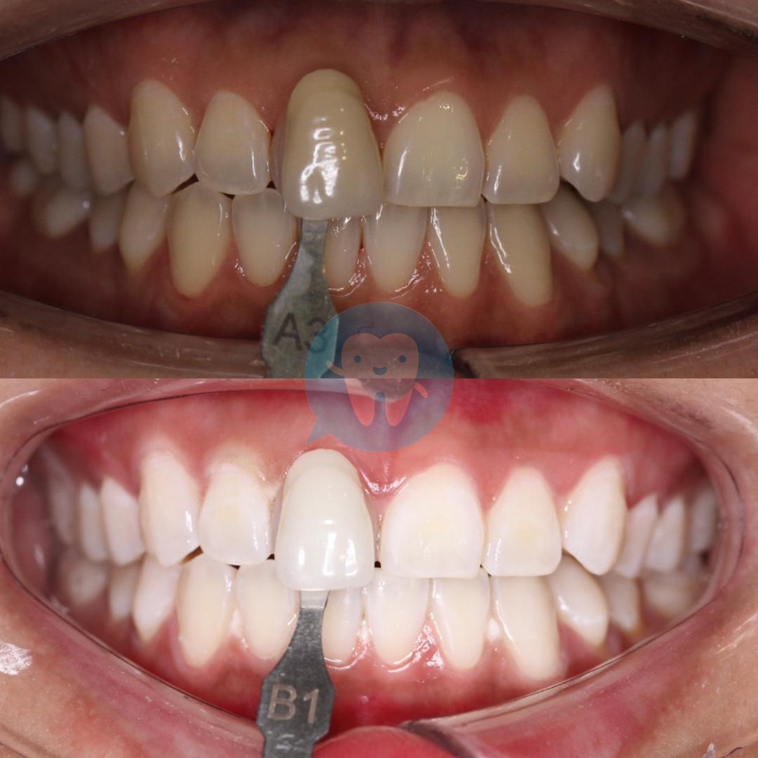 Hello Dental Clinic Subang — photo 2