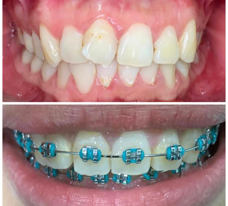 Hi-Dentist Cheras | Dental Clinic Alam Damai, Cheras — photo 3