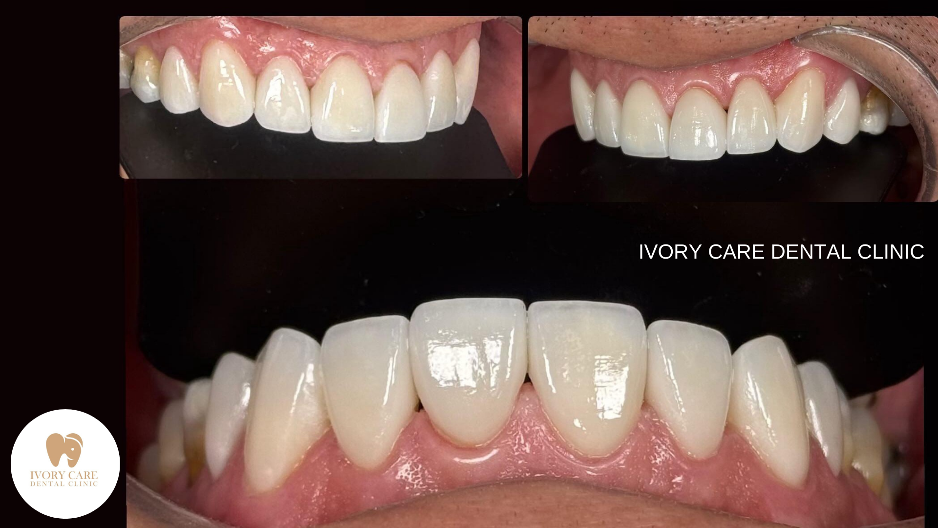 Ivory Care Dental Clinic • Bukit Mertajam — dental clinic in Malaysia