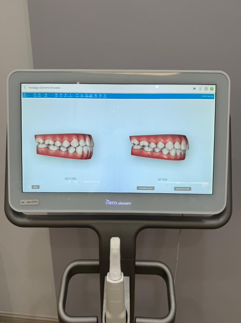 JIN SMILE Dental Clinic Sri Petaling (Invisalign Provider) — photo 5