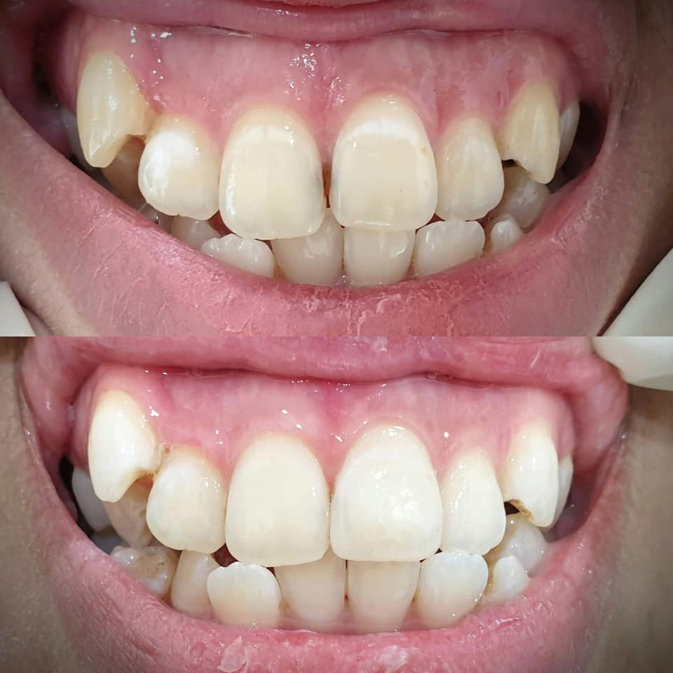 Kiwi Dental Clinic — photo 5