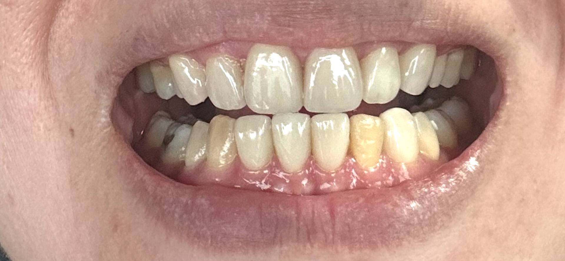 Klinik Pegigian Ha-teeth | Dental Clinic Muar (Johor) — photo 3