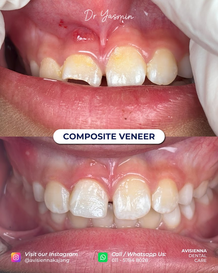 Klinik Pergigian Avisienna - Scaling, Teeth Whitening, Veneer, Aligner & Braces Kajang — photo 2