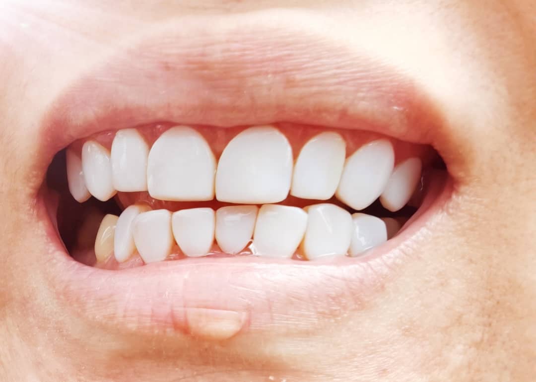 Klinik Pergigian Bangsar (SWASTA Klinik) — dental clinic in Malaysia