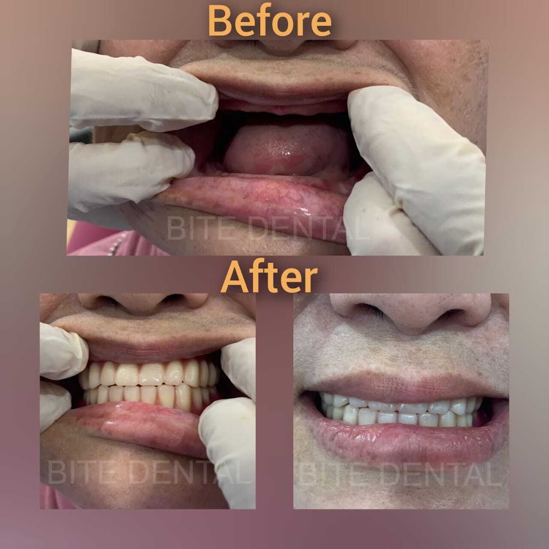 Klinik Pergigian Bite — photo 2