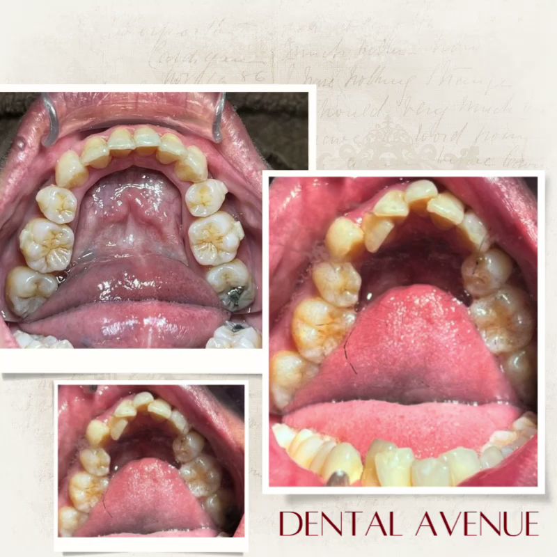 Klinik Pergigian Dental Avenue (Certified Invisalign Provider) — photo 5