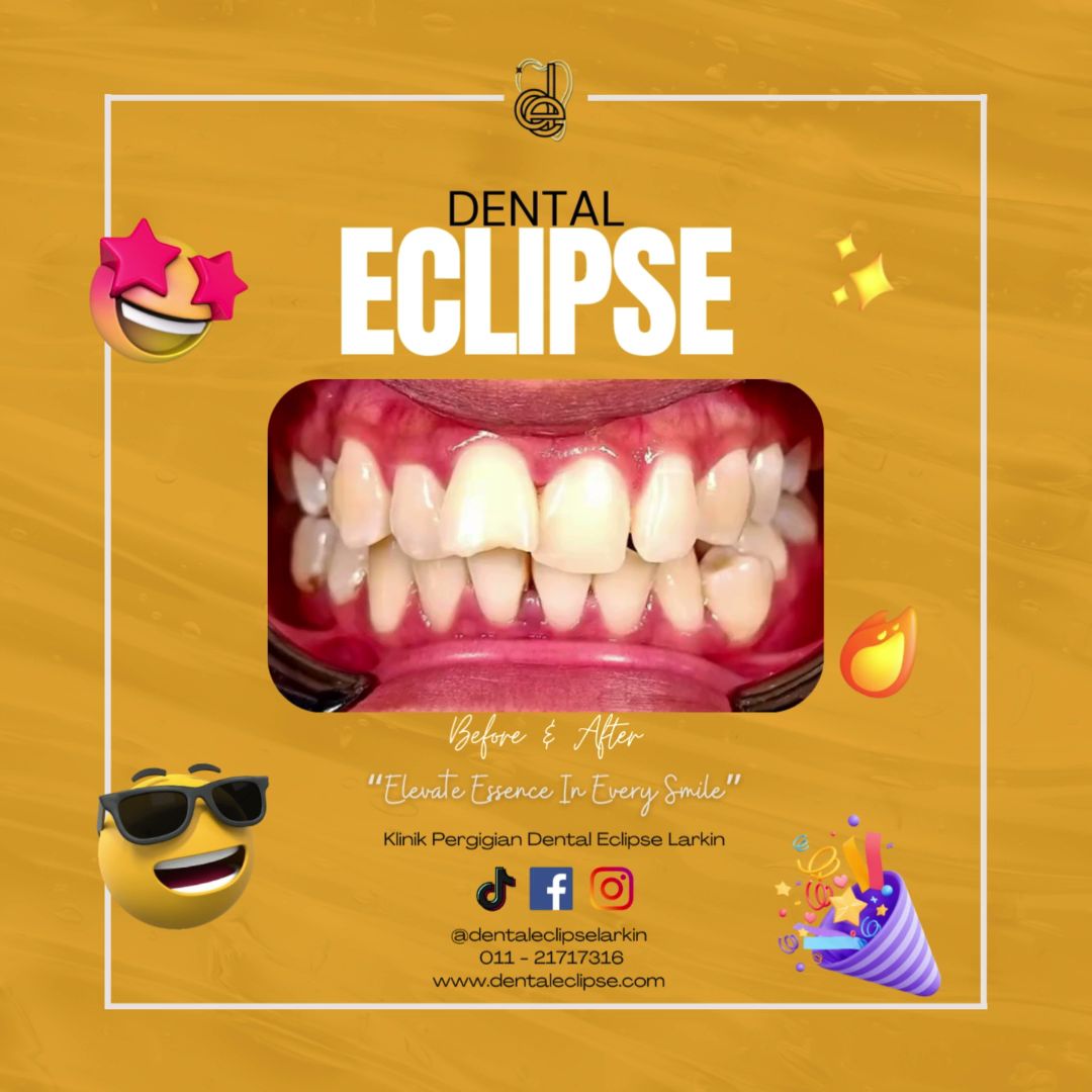 KLINIK PERGIGIAN DENTAL ECLIPSE PASIR GUDANG — dental clinic in Malaysia
