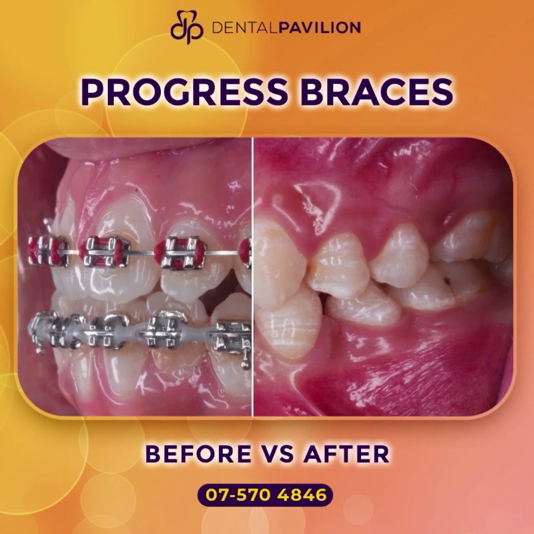 Klinik Pergigian Dental Pavilion Skudai Johor Bahru — photo 3