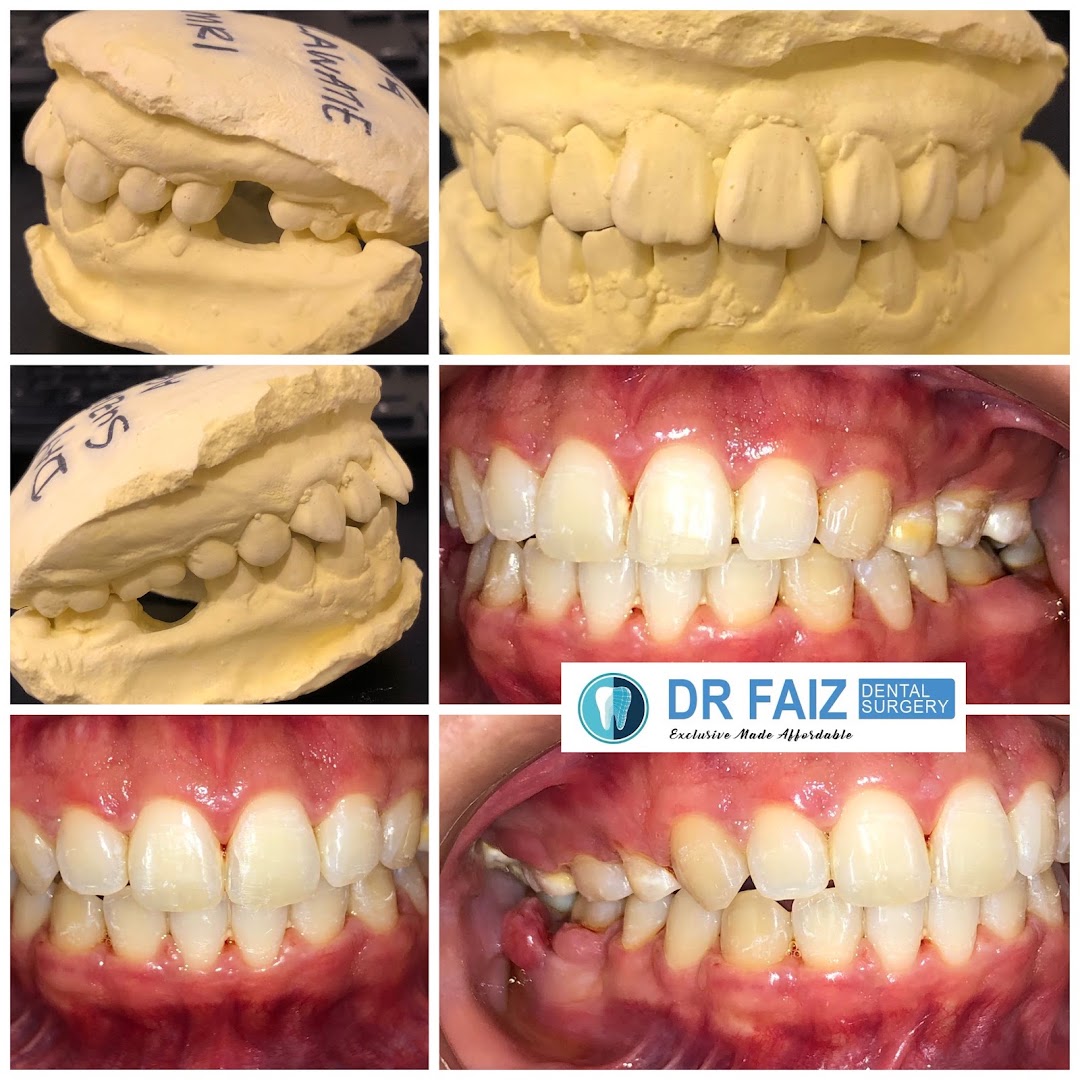 klinik pergigian dr faiz papar — photo 2