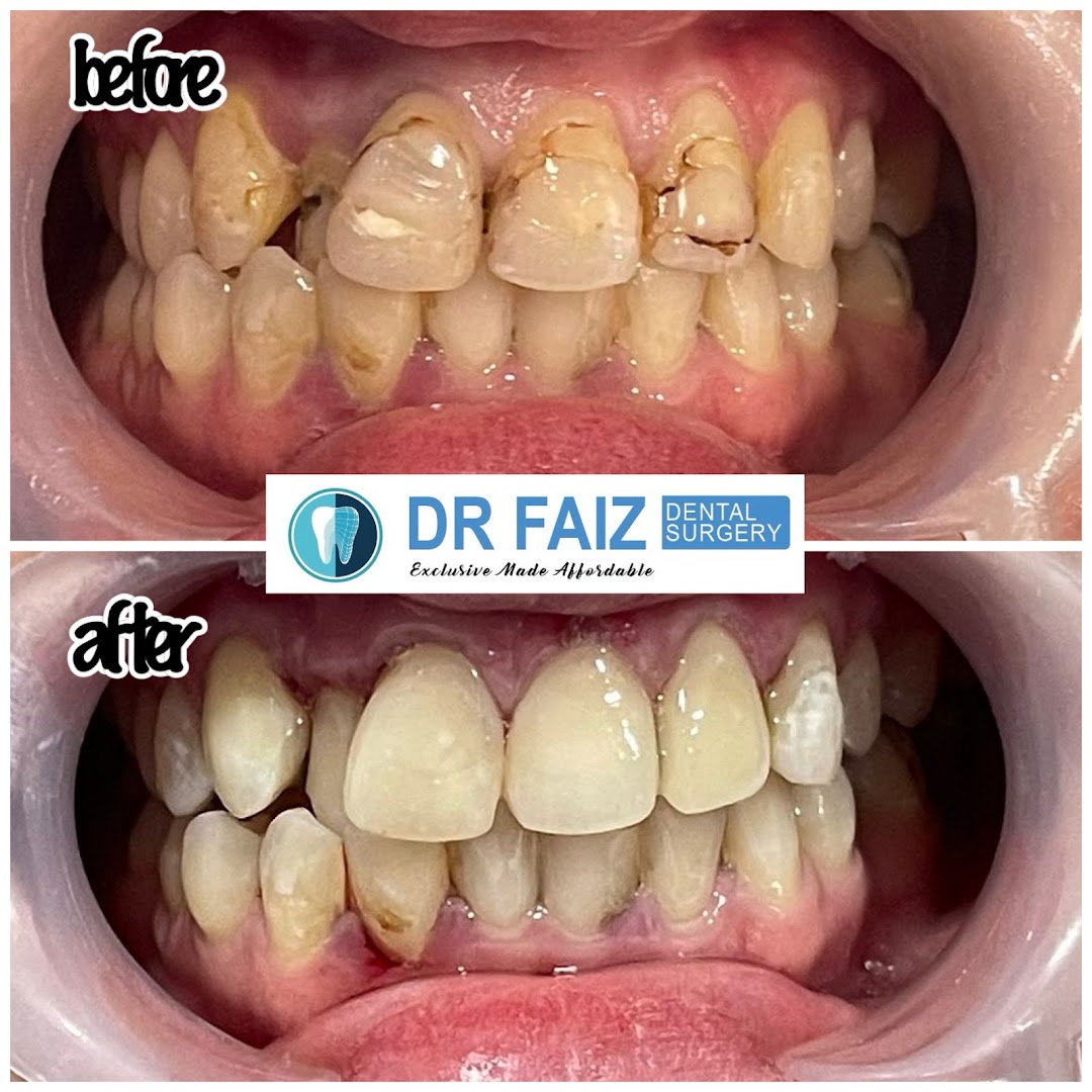 klinik pergigian dr faiz papar — photo 3
