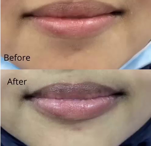 Klinik Pergigian Kajang Sentral (Certified Invisalign Provider) — photo 2