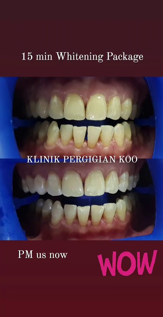 Klinik Pergigian Koo (Koo Dental Clinic)- Cheras Dentist — photo 2