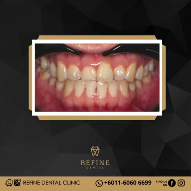 Klinik Pergigian Refine Dental — photo 2