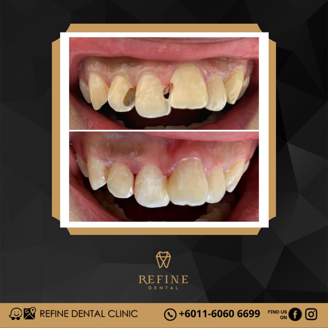 Klinik Pergigian Refine Dental — photo 3