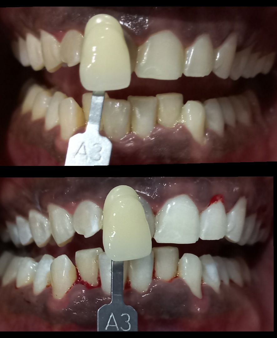 Klinik Pergigian Smile+ Dental Clinic Kepong - [Braces, Aligner, Teeth whitening] — photo 5