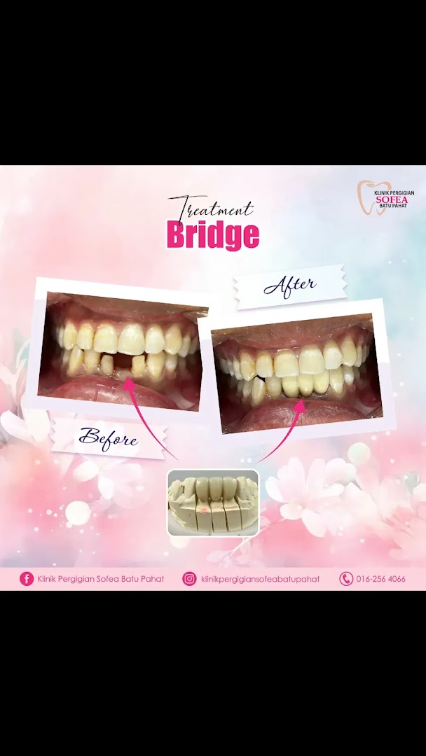 Klinik Pergigian Sofea Batu Pahat — photo 4
