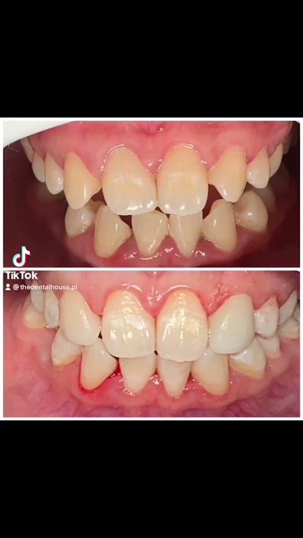 Klinik Pergigian The Dental House Putera Indah, Parit Yani, Batu Pahat, Johor(Family Friendly Dentist in Batu Pahat) — dental clinic in Malaysia