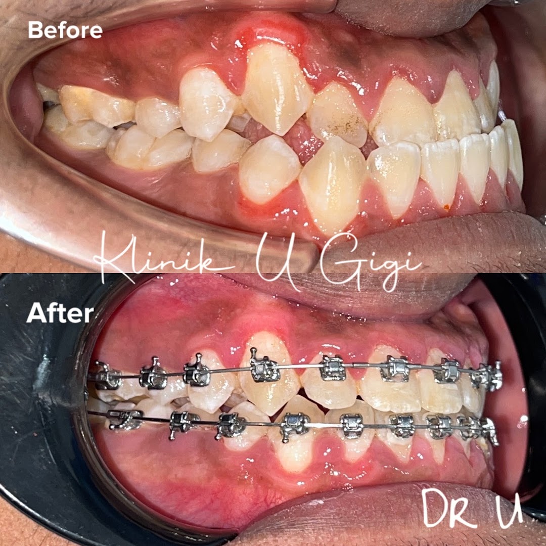 KLINIK pergigian U GIGI — photo 3