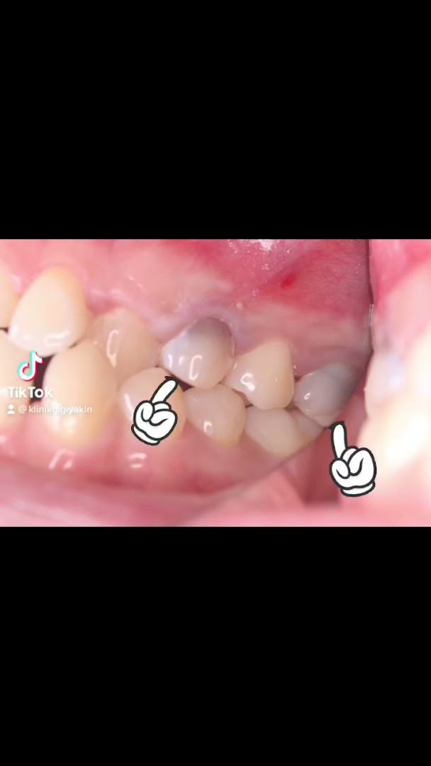 Klinik Pergigian Yakin — photo 2