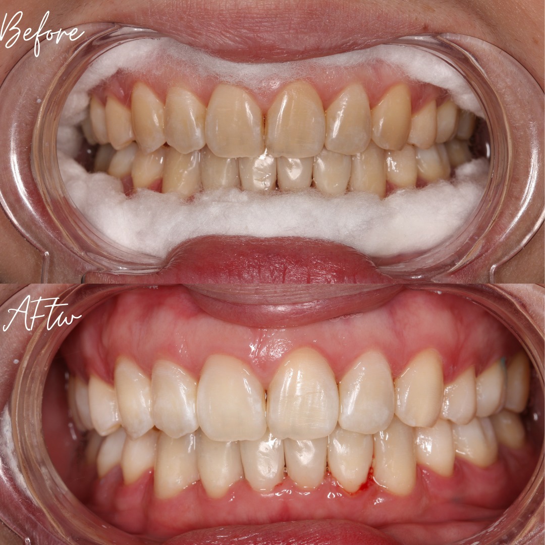 L&M Dental Clinic PJ (Dentist nearby ss2) — photo 3