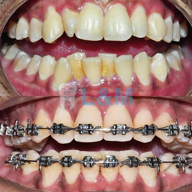 L&M Dental Clinic PJ (Dentist nearby ss2) — photo 4