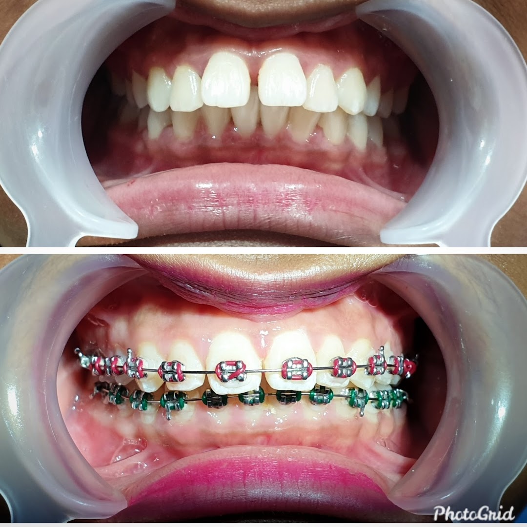 LD Dental Clinic | Klinik Pergigian LD @ Bandar Botanic Klang — photo 2