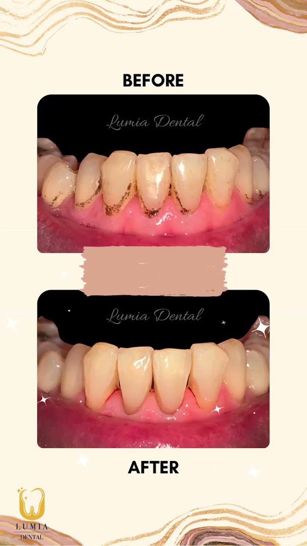 Lumia Dental Cheras 雪亮牙科诊所 — photo 3