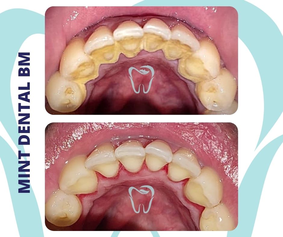 Mint Dental Bukit Mertajam — photo 4