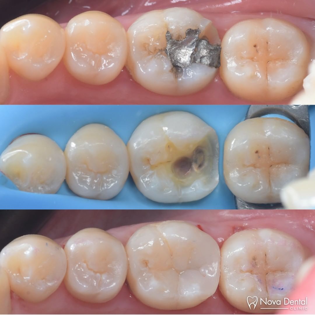 Nova Dental Clinic — photo 2