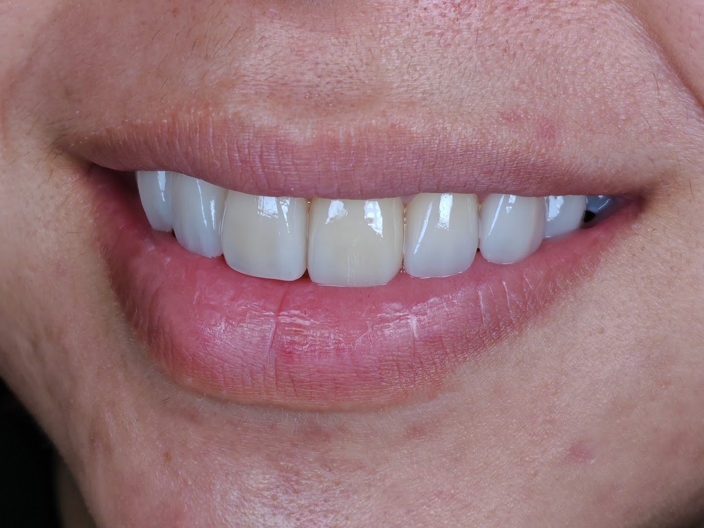 Phi Dental — photo 2