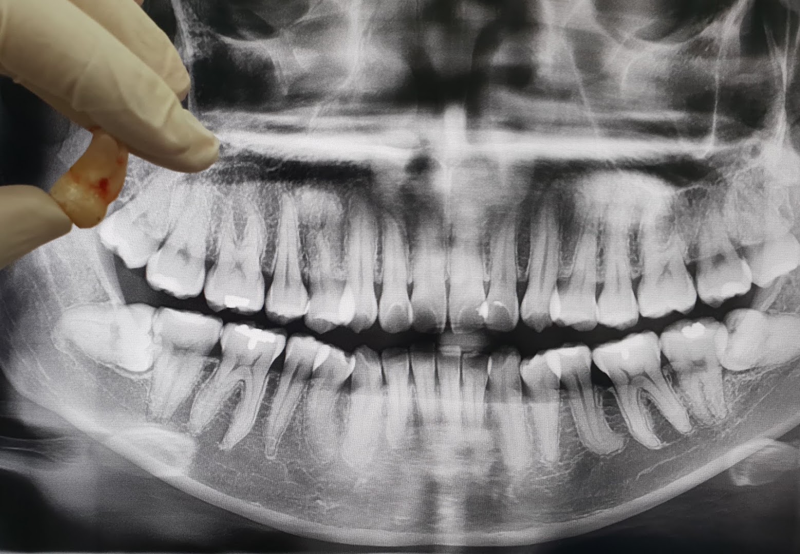 Qualiteeth Dental Clinic (Kepong Baru) — photo 2