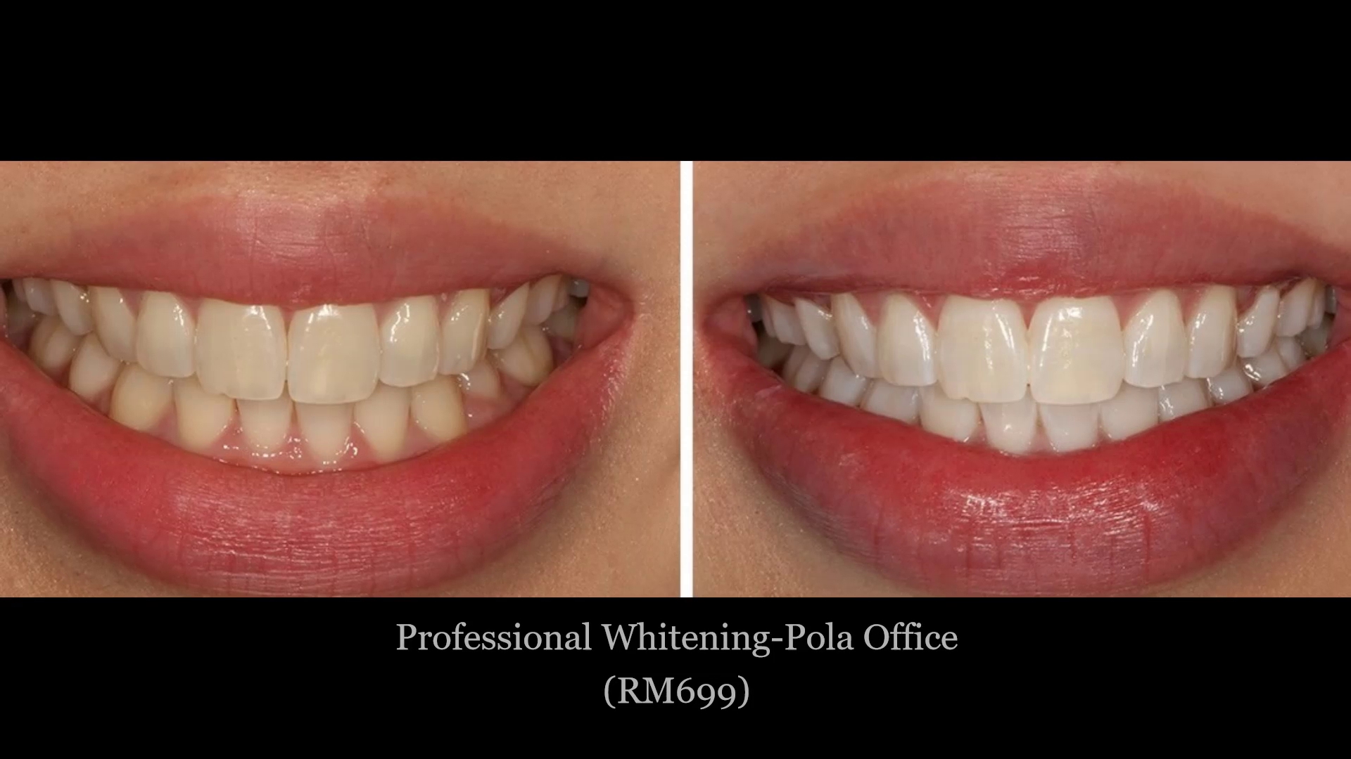Qualiteeth Dental Clinic 优质牙科@ Rawang (Opens Everyday)- Braces Centre since 2017 — photo 2