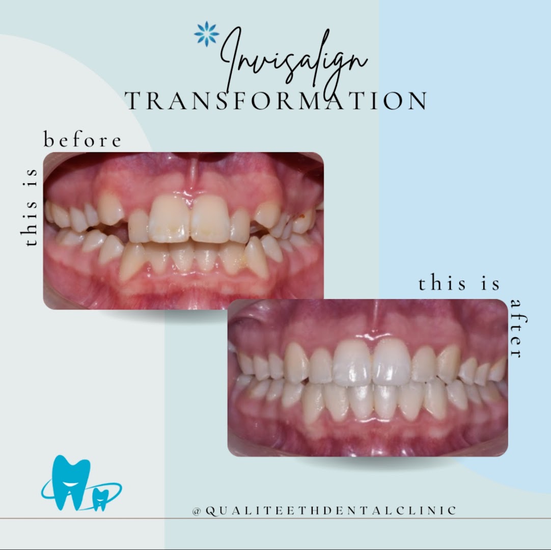 Qualiteeth Dental Clinic @ Taman Seri Bintang ( Braces and Implant Dental Centre) — dental clinic in Malaysia