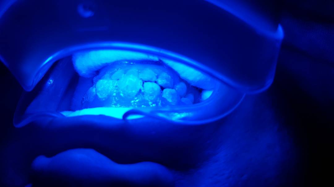 Royal Smile Dental Clinic ( Klinik Pergigian Royal Smile) — photo 3
