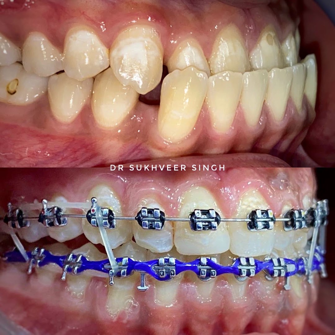 Singh Dental Clinic , Klinik Pergigian Singh Dental ( Braces , Invisalign , Comfortable Dental Experience ) — photo 3