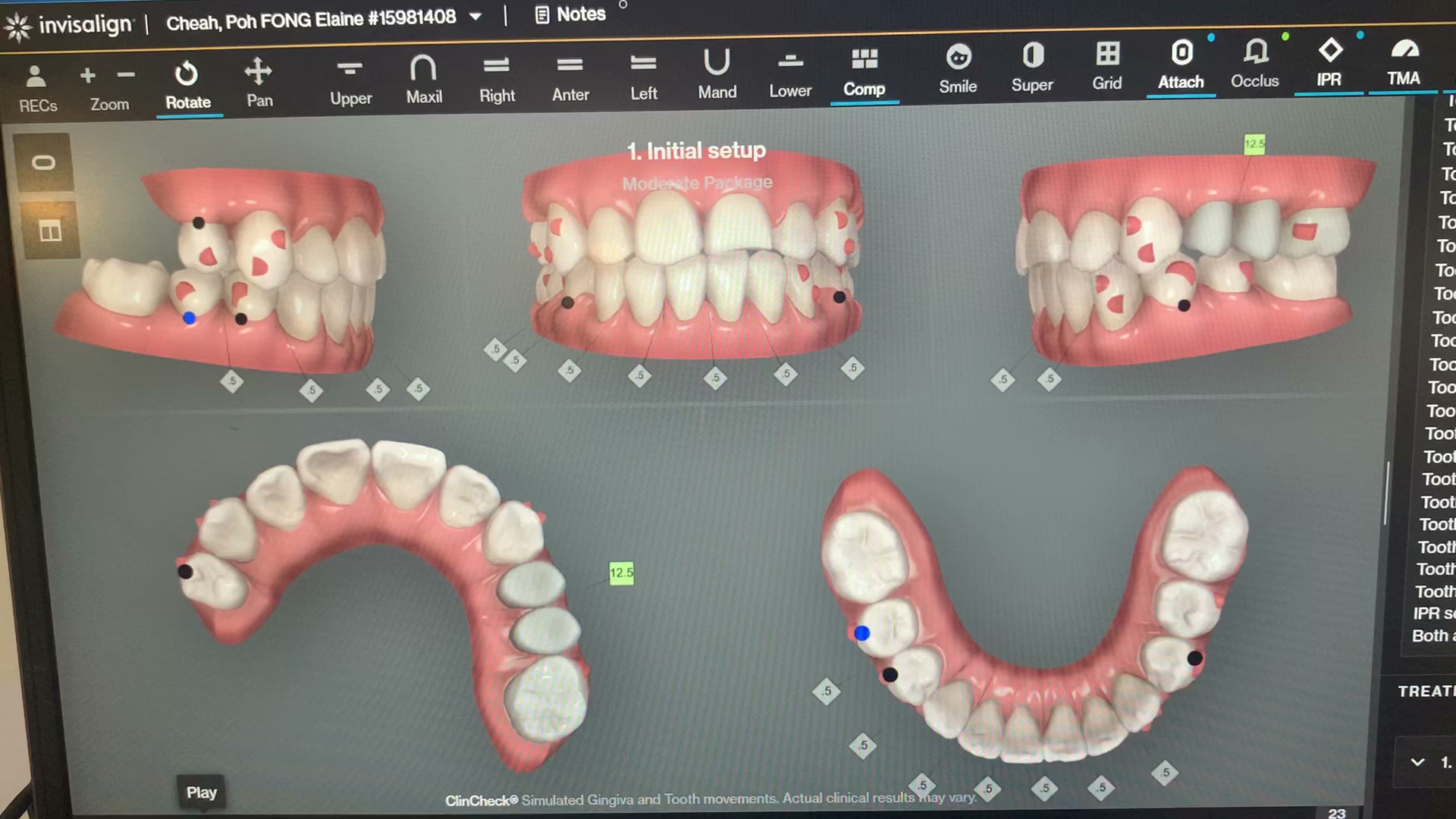 SMILE 28 Dental Clinic @ Lukut / Port Dickson (HQ) — photo 2