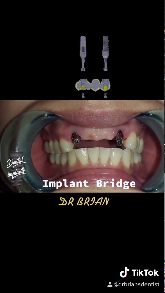 SMILE 28 Dental Clinic @ Lukut / Port Dickson (HQ) — photo 3