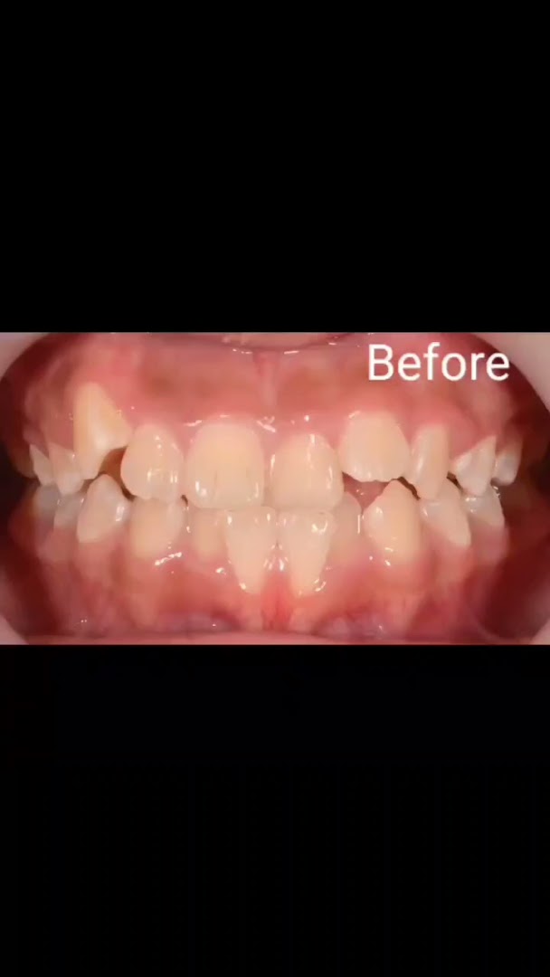 Smile Arts Dental Kepong — photo 2