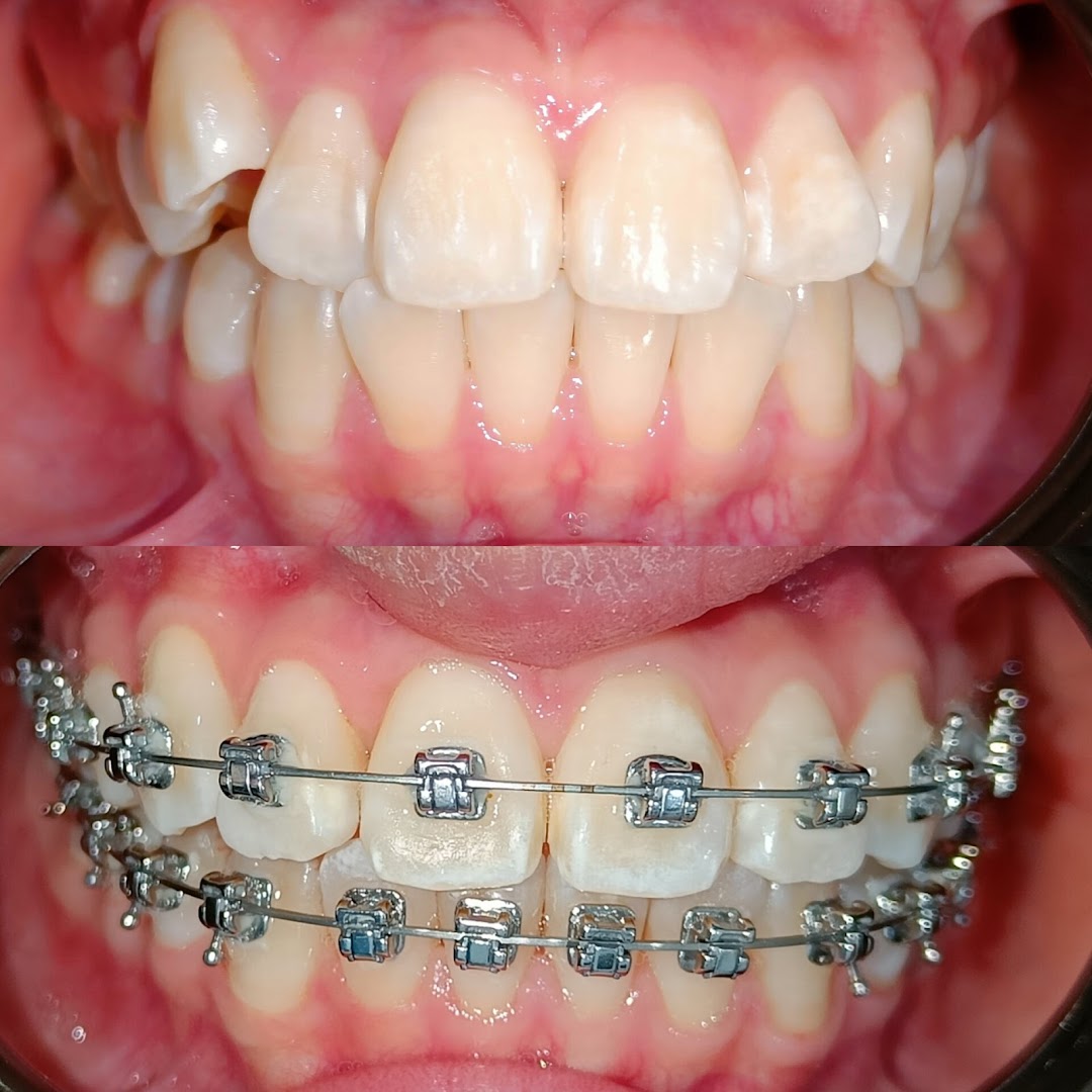 Smileage Dental Clinic KL — photo 3