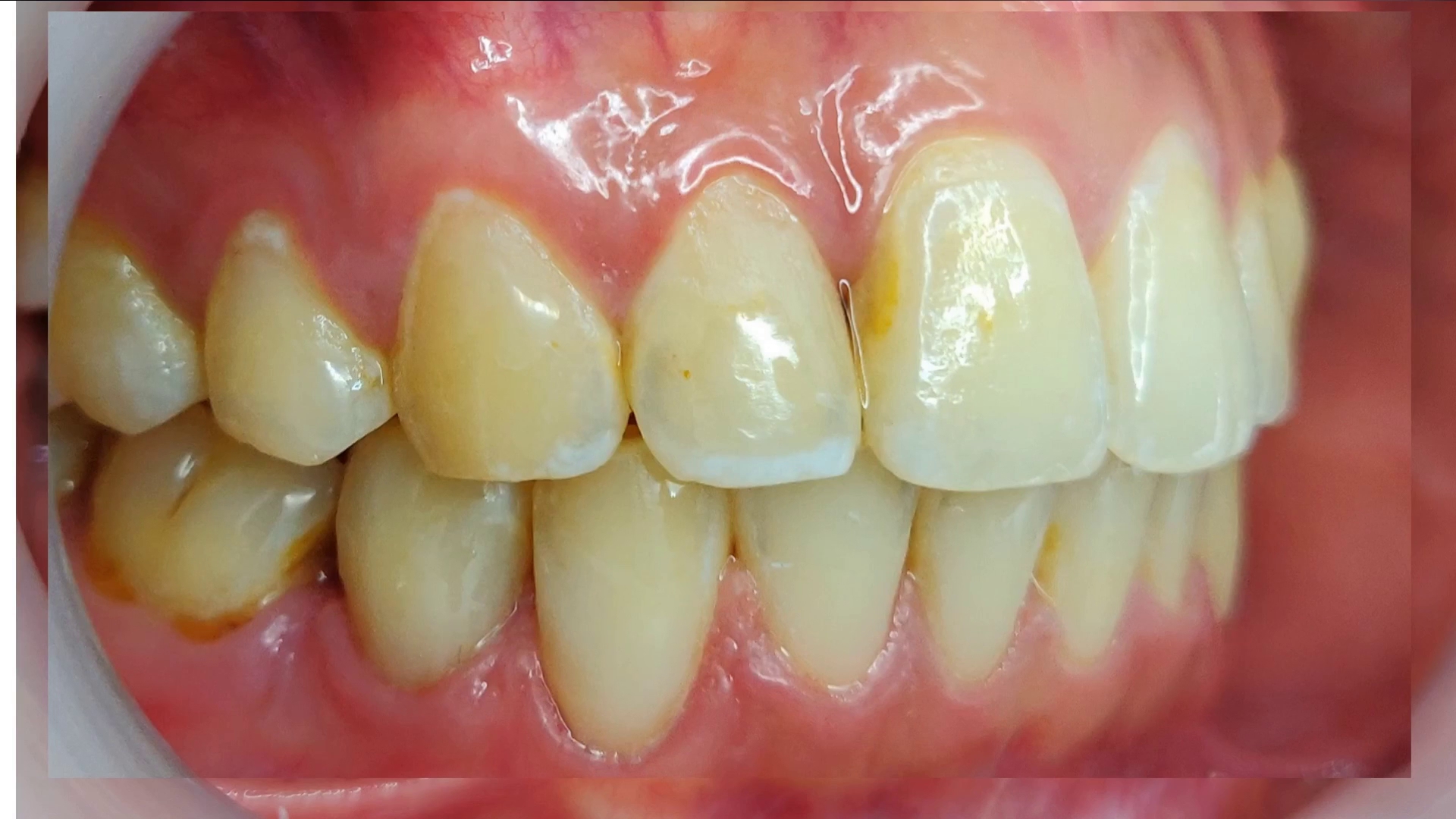 SmileGram Dental Clinic PJ (Petaling Jaya) — photo 2