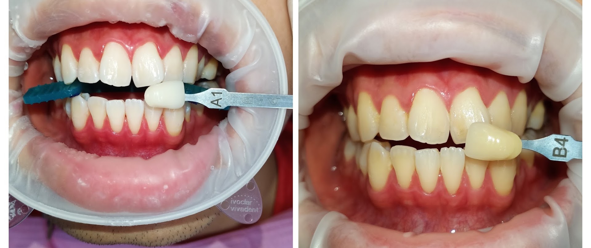 Smiley Tooth Dental Clinic — photo 3