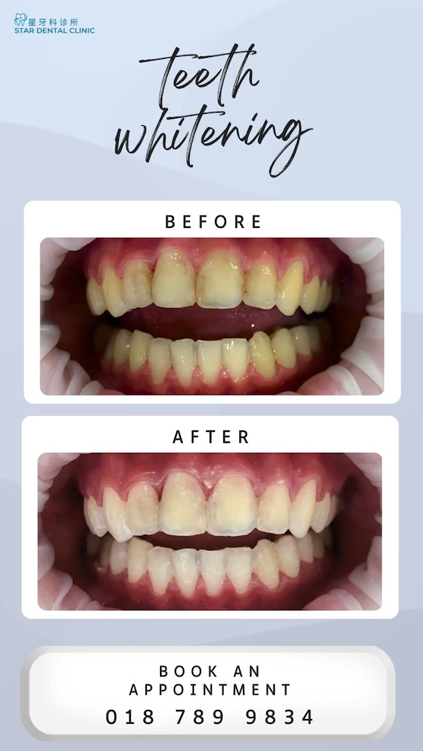 Star Dental Clinic Bukit Mertajam - Implant & Braces Centre 大山脚星牙科 种植牙和绑牙中心 — photo 3